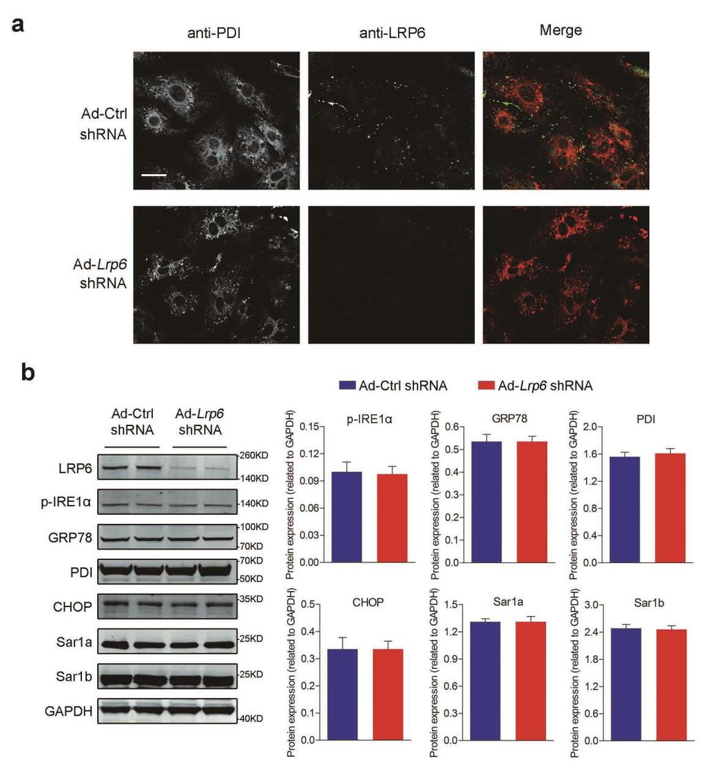 Supplementary Figure 8. Effects of LRP6 reduction on the ER morphology and function. (a) Immunofluorescent imaging of ER in LRP6-deficient cardiomyocytes. PDI: a ER marker. Scale bars, 10 µm.
