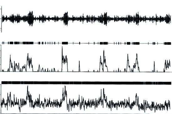 Firing Rate (Hz) EEG ( V) Parietal