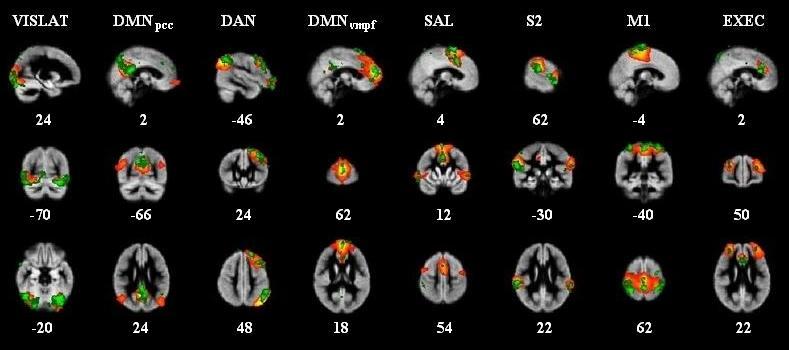 fbeeg-isfs are correlated with fmri BOLD signals in intrinsic connectivity networks Hiltunen,.., Palva, J. Neurosci.