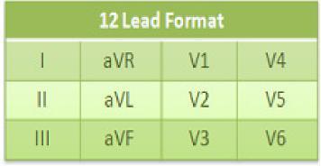 Format of the Printed 12 Lead ECG The 12 Lead ECG has a standardized format.
