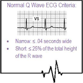 Normal Q Waves Normal Q waves are an indication of normal septal depolarization. After the atria depolarize, the septum depolarizes, followed by the right and left bundle branches.