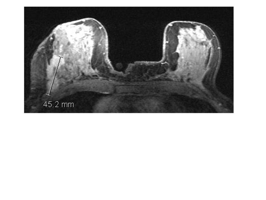 Fig. 4: High resolution axial image.