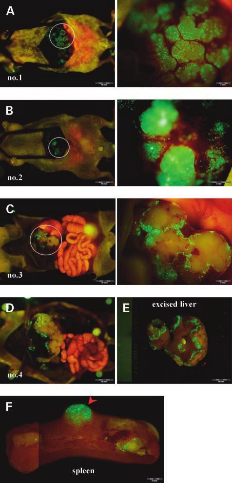 Animals were examined at laparotomy by fluorescence imaging with the OV100 5 days after OBP-401 was administered. Some mice Figure 4.