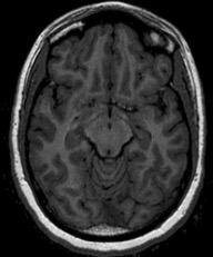 3 = 1 Benefits of high-field MRI