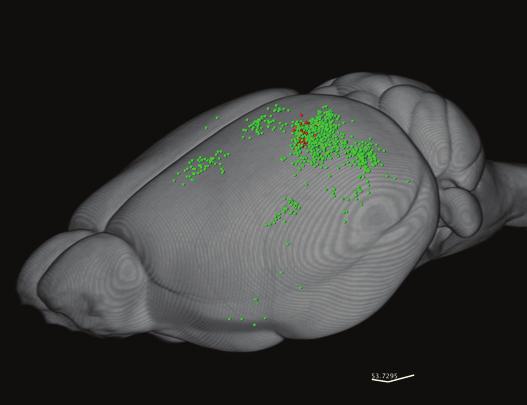 5mm tissue 2 0-2 - - 6-8- 2 6 DLG V1 AuD Au1 C Overlay and Transfer to brain model