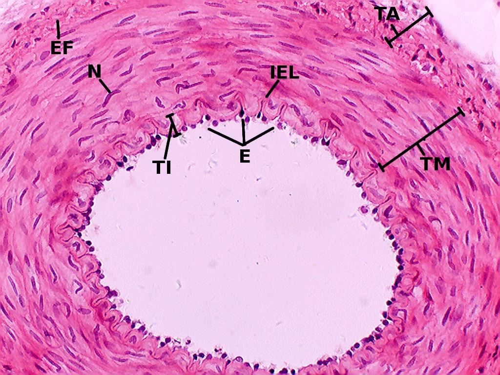 Diagnosis? 2. In which of the following layers of a muscular artery would you find smooth muscle? A. Tunica intima B.