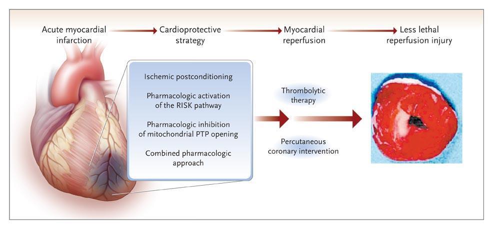 New Cardioprotective Strategies for Reducing Lethal