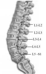 Vertebral Morphometry [10] is a computerized quantifying technique for measuring the vertebrae on lateral radiographs of the spine. Hedhund, et al.
