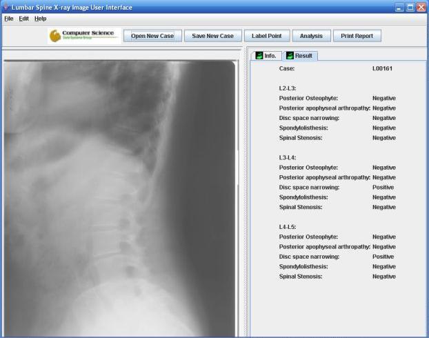 The user interface for managing training images and building lumbar spine classifiers. Figure 7. The end-user interface for submitting X-ray images for analysis of spinal conditions. 5.