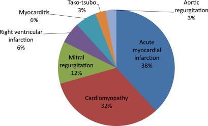 Causes of Cardiogenic Shock