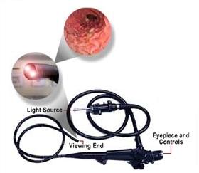 By adjusting the various controls on the endoscope, the endoscopist can safely guide the instrument to carefully examine the inside lining of