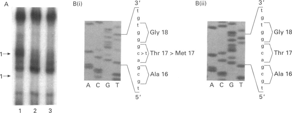 34 Bell, Converse, Hmmer, Osborne, Hites F-6246 Figure I Pedigrees of ptients with muttions identified in the rhodopsin gene. Individuls testedfor the presence of the prticulr muttion re indicted (*).