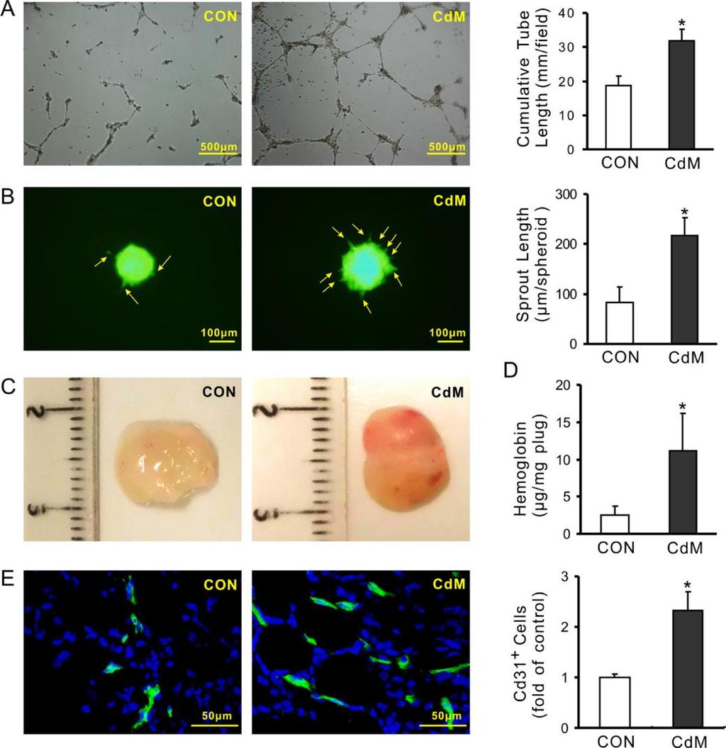 Conditioned medium derived from MSCs promotes angiogenesis Tube-like structure formation of HUVECs Spheroid-based sprouting of HUVECs Tube lenght and sprouth lenght per spheroid was significantly