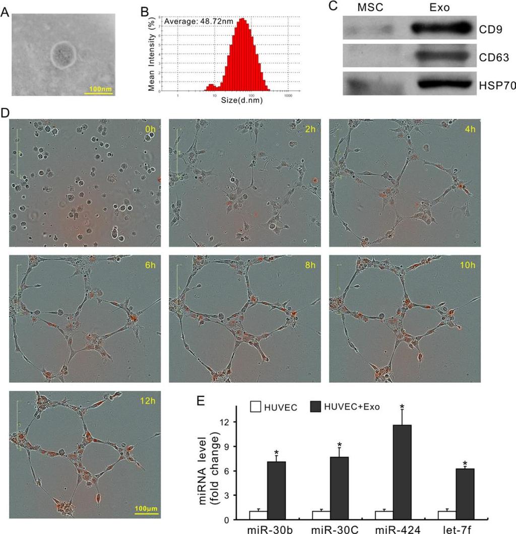 Characterization of exosomes derived from MSCs Internalization of exosomes pre-labeled with PKH26 (red fluorescence) by HUVECs reached its maxiumum after 10