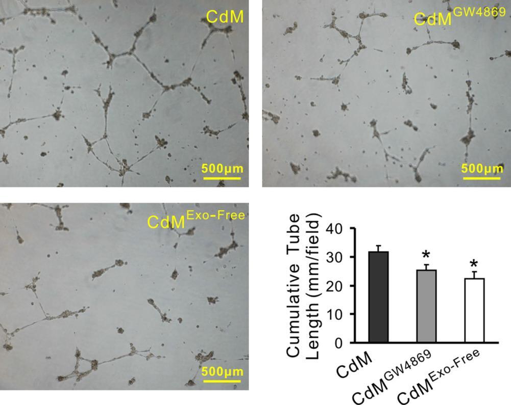 Exosomes derived from MSCs promote angiogenesis Pro-angiogenic capacity