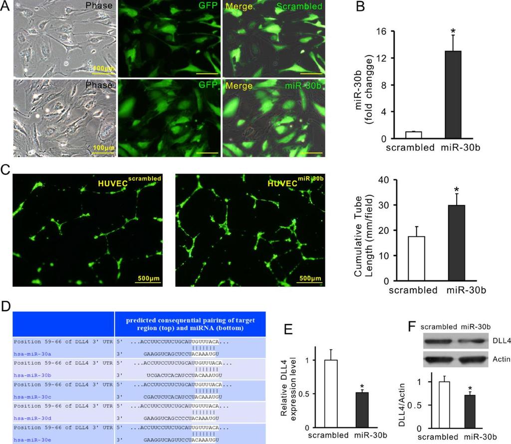 Pro-angiogenic properties of exosomes Overexpression of mir-30b in HUVECs using lentiviral system Increased expression of mir-30b and tube length in HUVECs