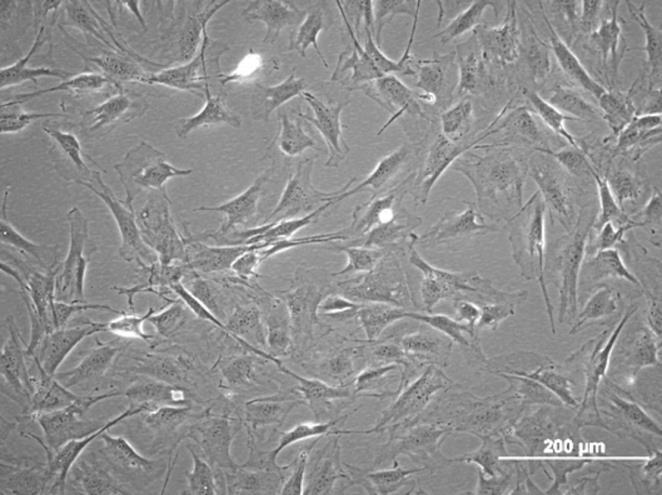 Mesenchymal stem cells (MSCs) non-haematopoietic, multipotent stem cells with the capacity to differentiate into mesodermal lineage such as osteocytes, adipocytes and chondrocytes as well ectodermal