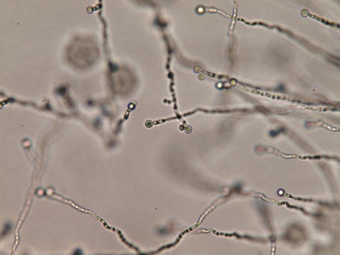 Chlamydospores