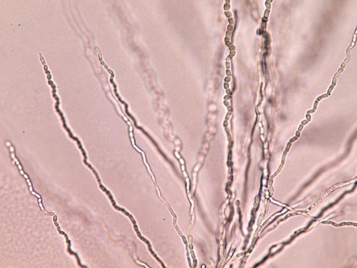 Arthroconida Urea test Arthroconidia Done together with yeast morphology, to help identification of yeast.