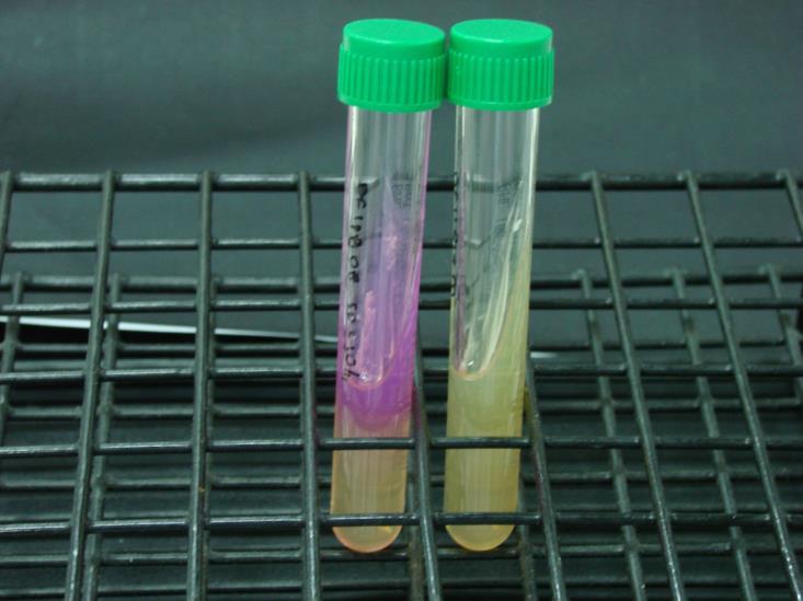 Urease test Positive turns pink Identification of yeasts (4) germ tube test for Candida species Once narrowed down to Candida species, perform germ tube test.