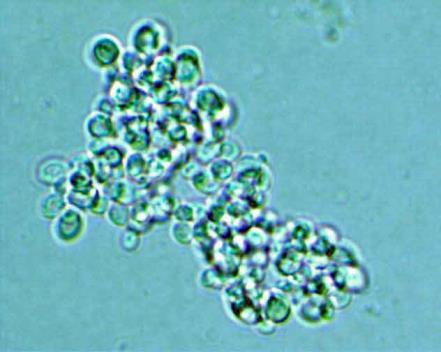 species, and some of the other yeasts) API (20C AUX) Vitek 2 (ID-YST) Microscan (Yeast