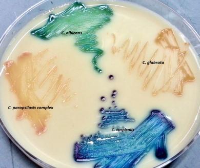 Another chromogenic agar Brilliance TM Candida agar (Oxoid) Cryptococcus Candida albicans : green Candida glabrata and parapsilosis complex : biege Candida tropicalis : dark blue Culture isolates are
