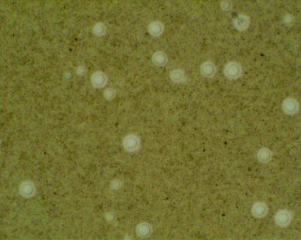 Cryptococcus Major yeast infecting humans. More prominent because of AIDS.