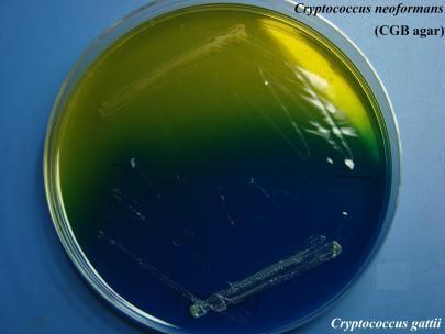 Cryptococcus on canavanine glycine bromthymol blue (CGB) agar Malassezia C. neoformans : no change in colour C.