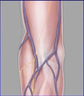 Compression from biceps brachii tendon
