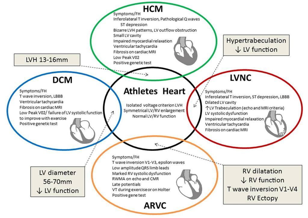 Athletes heart vs.