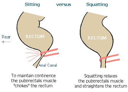 Correct sitting position Have ever felt that after you have evacuated, there is still something left? SITTING When you are SEATED, the anal canal is unstraightened.