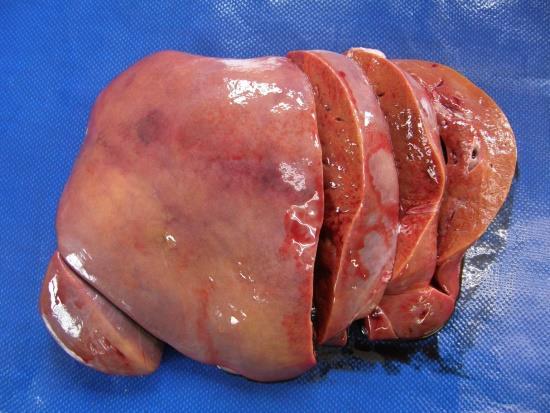 of portal veins and tortuous hepatic arteries.