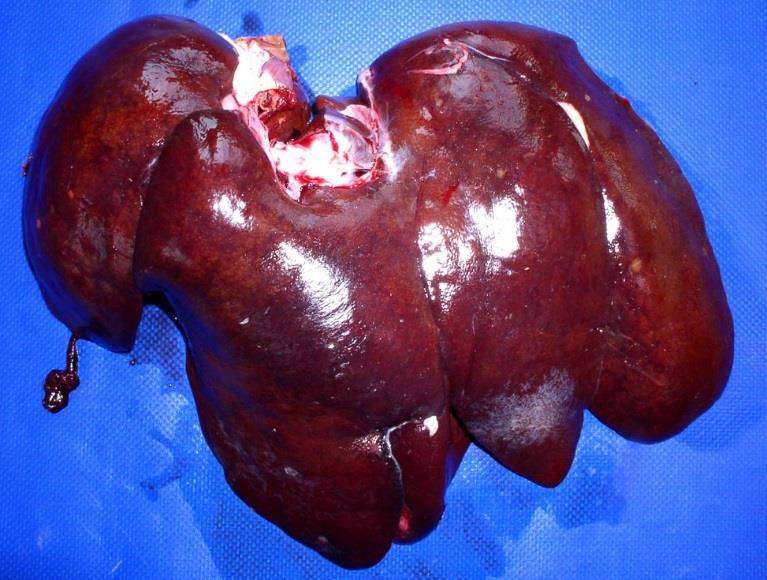 Common Gross Liver Lesions Figure 8 Diffusely enlarged liver (hepatomegaly) May be seen in a variety of conditions where there is either diffuse swelling of hepatocytes, blood pooling or diffuse