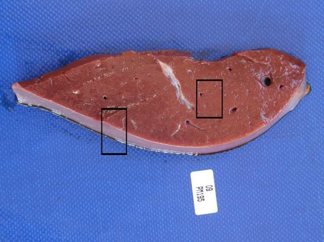 grossly visible lesions. Liver sections should include tissues with capsular tissue as well as tissue from at least 1cm below the capsule (Figures 23 and 24).