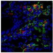 Labeling of macrophages: In vitro: In vivo: RAW cells PBMC