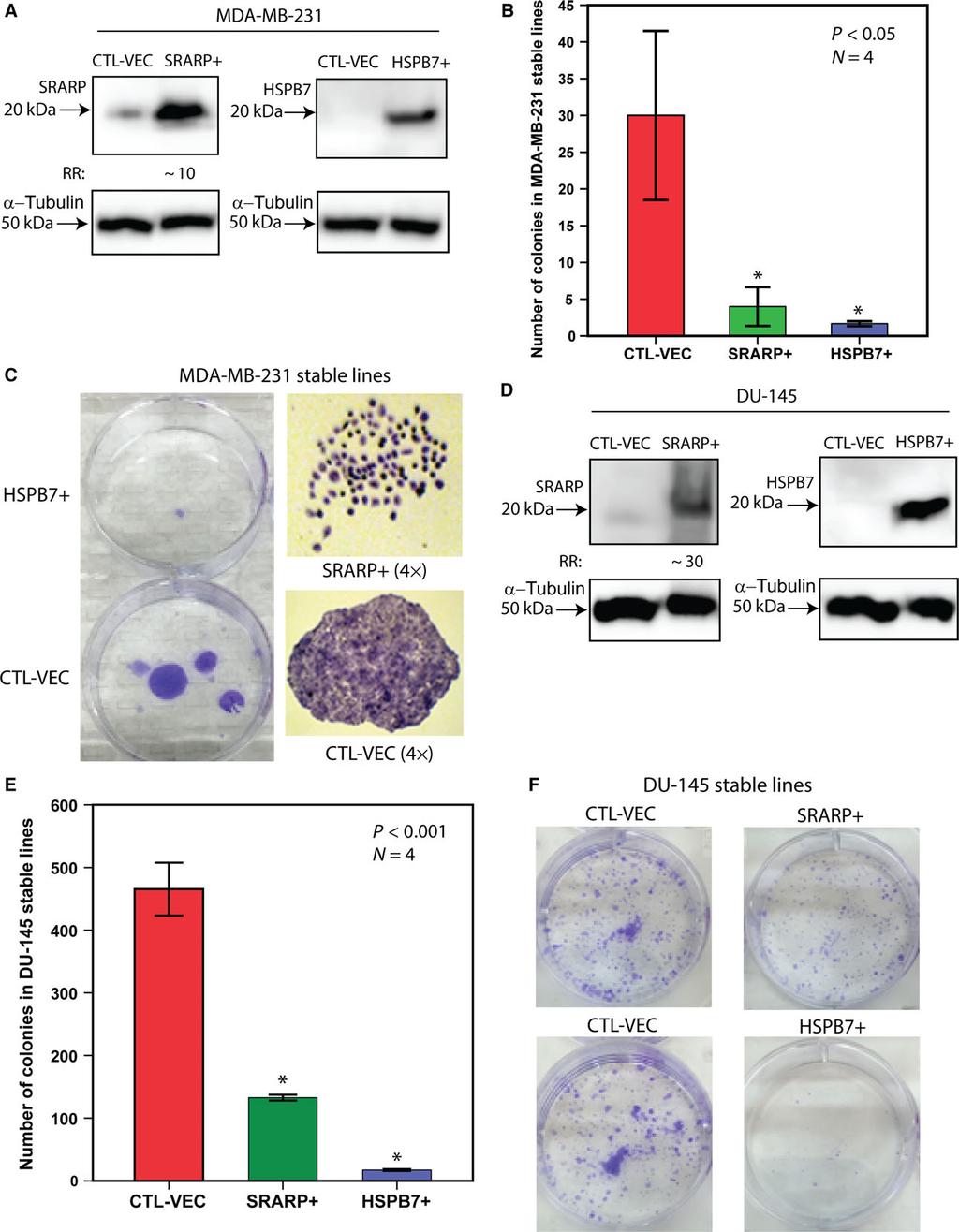 A. Naderi SRARP and HSPB7 are tumor suppressors Molecular Oncology 12 (2018)