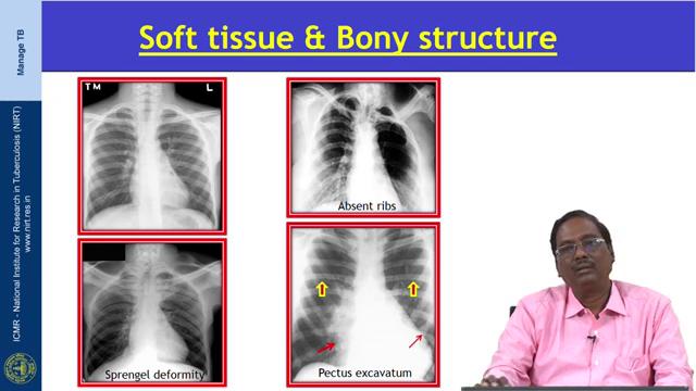 (Refer Slide Time: 08:46) Then after completing after verifying the quality of the X-ray then we have to start interpreting the findings.
