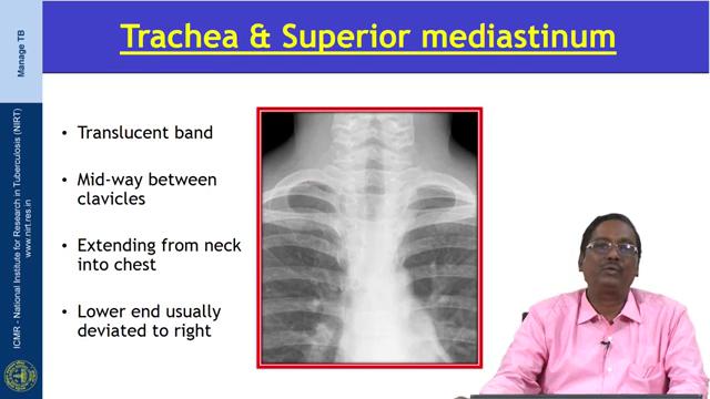 Next we have to see the mediastinal structures, the upper part of the mediastinum this is of the tracheal the tracheal we have to see the tracheal shadow, cardiac shadow under mediastinal contour.