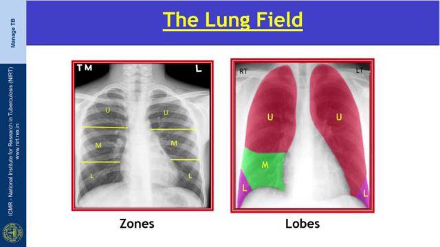 (Refer Slide Time: 13:40) So, right diaphragm is slightly higher than the left and we have to check the sharpness of the borders, dome lies in the midclavicular line between fifth and seventh