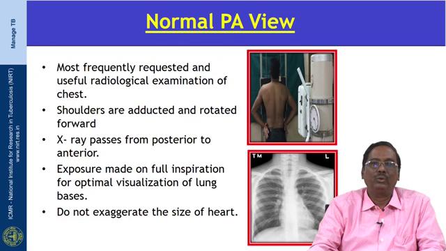(Refer Slide Time: 04:34) So, this is the normal PA view it is a most frequently requested and useful radiological examination of the chest.
