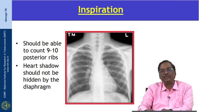 (Refer Slide Time: 06:19) So, next is the inspiration; conventionally all the X-ray have been acquired in a erect posterior in a