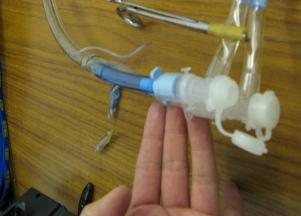 Disconnect (remove the cap) the bronchial tube (left tube in the Lt.