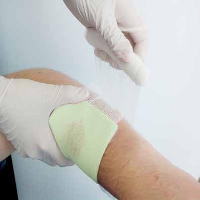adhesive zone is transparent and allows visual inspection of the area surrounding the wound NON-ADHESIVE COMPRESS Suitable for the treatment of chronic wounds For wounds with potential for infection,