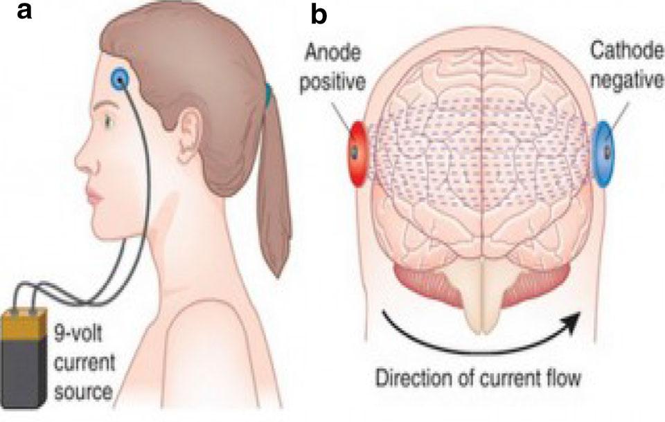swallowing and influences on dysphagia. This review aims to give a historical perspective on noninvasive brain stimulation and its uses in the management of dysphagia.