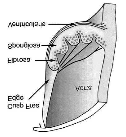 Aortic leaflets: histology I Aortic leaflets.