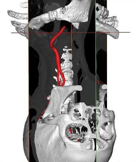 Arteries Aorta F.