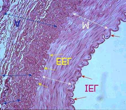 Arteries: histology I Artery wall is made of three concentric layers tunica adventitia (A),
