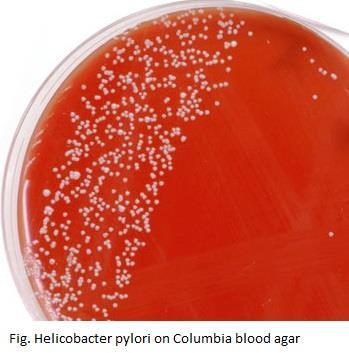 H. pylori Culture from Biopsy Specimens Grows slowly on agar ---