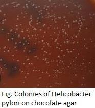 pylori on Columbia blood agar Microaerophilic conditions are