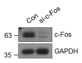 11 Supplementary Figure 9. Effects of c-fos sirna on cytokine gene expression. RAW264.7 cells were transfected with 10 nm control sirna (Con) or c-fos-specific sirna (si-c-fos) for 36 h.